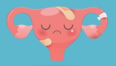 收藏！宫腺肌症妇女一定要了解这些关于怀孕的建议