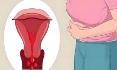 紧急避孕药会导致月经紊乱吗?紧急避孕药对女性有哪些伤害?