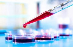 为什么体检、看病总是要“抽血”，能查出什么问题？