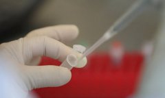 检查染色体是试管的必备程序，一文了解染色体检查的两种方法