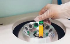 试管冻胚怎么保存好？冻胚温度多少合适？