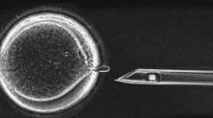 试管短方案过程的基本原理，试管短方案过程有这些优点