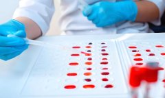 试管移植的实施原理是怎样的?试管移植成功案例有哪些?