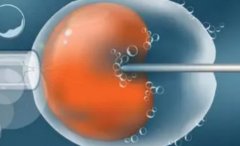 韩国试管技术怎么样，性别选择技术存在一些缺点