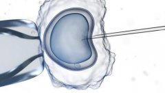 收藏！一文了解乌克兰借卵试管的优缺点