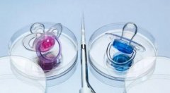 49岁的女性试管可行吗？成功率怎么样？