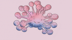 澄清误区：畸胎瘤并非胎儿夭折于腹中的现象！