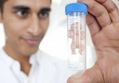 试管技术原理解读，价格套餐包括这些费用