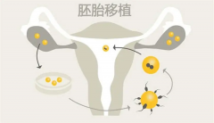 三代试管取卵后一般3-5天可移植，胚胎发育好更易成功