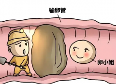 双侧输卵管堵塞能做试管吗？会不会造成宫外孕？