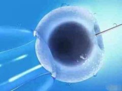 揭秘！试管第二次移植冻胚的全面流程及费用概览