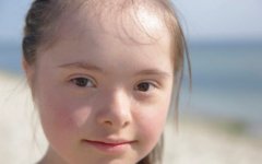 唐氏儿有哪些症状，试管技术能阻断唐氏儿吗？