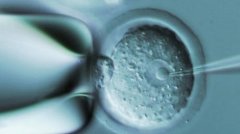 一文了解玉溪借卵试管到底需要多少钱？