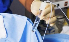 三代试管取卵后，多久可以移植呢？