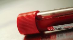 【科普】判断怀孕的几种方法