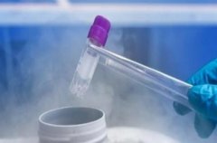 试管取卵手术全过程，太太需要注意调整自己的情绪