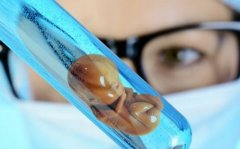 实现夫妻婴儿梦，试管周期注意事项有哪些？