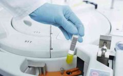 试管会影响到月经吗？女性应该保持良好的心态