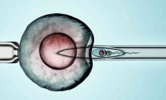 试管卵泡太多会怎么样，什么因素导致的？