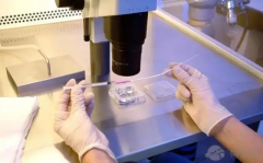 结扎与生育能力恢复：全面解析结扎手术及其可逆性