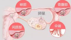 如何处理输卵管堵塞？哪些人适合做试管？