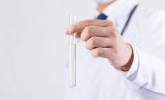 什么是试管？试管进周后要注意这些事项