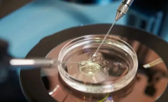 试管胚胎移植后的关键注意事项与护理要点