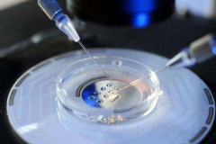 试管与自然受孕，你需要了解的关键差异点