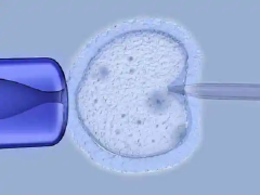 试管长方案全解析：从起点到终点，每一步都需细致了解！