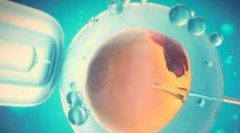 什么是卵泡？卵泡快速涨大的这些危险要注意