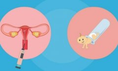 如何进行蛋白粉多囊试管检测？蛋白粉多囊试管的优势是什么？