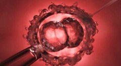 一文带你了解自然周期取卵和促排卵的区别