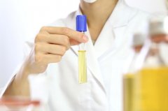 试管助孕前，这些检查不能遗漏