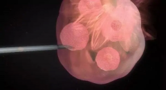 试管后的新篇章：深入解析排卵针治疗的作用与注意事项