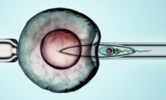 试管移植前谈话都包括哪些内容？对手术效果有影响吗？