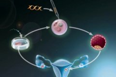 试管费用包含哪些项目？怎样提高试管成功率？