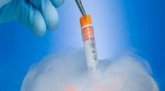 试管治疗需要多少钱？如何缓解试管治疗的经济压力？