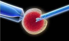 试管技术：二代与三代的抉择，探寻最适合您的方案