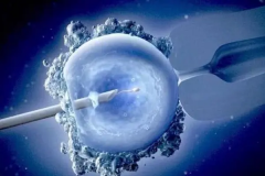 试管费用全解析，西北妇幼提供专业详尽的咨询解答！