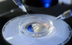 试管费用大对比：第一代VS第三代，明智选择更心安！