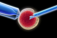 国内进行第三代试管的条件与流程,您需了解的关键信息!