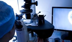 如何评估一个医生在试管移植方面的专业水平?试管移植的成功率与医生