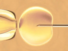 试管方案费用深度剖析，了解不同方案的成本构成与差异