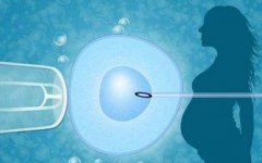 一文解析三代试管技术步骤，这些人群适合三代试管技术