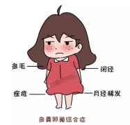 【专家答疑】多囊卵巢综合症应该做试管还是人工授精？