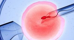 试管技术介绍，关于试管技术中的性别选择