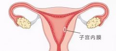 内膜太薄，如何孕育宝宝？