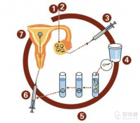 试管移植后康复的积极信号：这些迹象预示您正逐步摆脱腹水困扰
