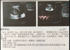 为什么要进行孕期监测？超声复查有哪些注意事项？