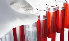 试管移植血值翻倍是什么意思?试管移植后翻血值是什么?